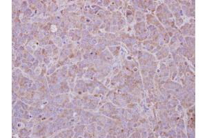 IHC-P Image MAGEB1 antibody detects MAGEB1 protein at cytosol on MCF-7 xenograft by immunohistochemical analysis. (MAGEB1 antibody  (Center))