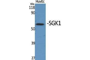 Western Blot (WB) analysis of specific cells using SGK1 Polyclonal Antibody.