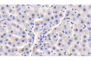 Detection of vHL in Rat Liver Tissue using Polyclonal Antibody to Von Hippel Lindau Tumor Suppressor (vHL) (VHL antibody  (AA 6-175))