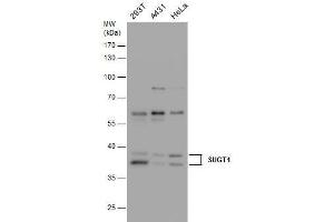 WB Image SUGT1 antibody detects SUGT1 protein by western blot analysis. (SUGT1 antibody  (Center))