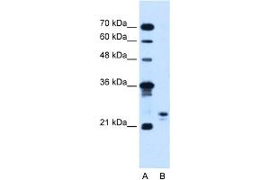 WB Suggested Anti-MOSPD3 Antibody Titration:  5. (MOSPD3 antibody  (C-Term))