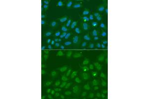 Immunofluorescence analysis of A549 cells using ORC6 antibody (ABIN6293429).