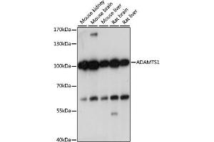 Western blot analysis of extracts of various cell lines, using  antibody (ABIN7265439) at 1:1000 dilution. (ADAMTS1 antibody  (AA 718-967))