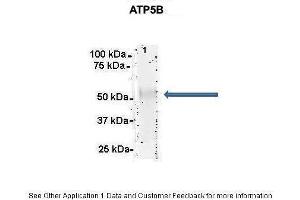 Researcher: Dr. (ATP5B antibody  (C-Term))