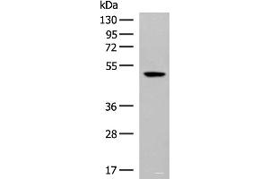 Western blot analysis of Hela cell lysate using GPR142 Polyclonal Antibody at dilution of 1:400 (GPR142 antibody)