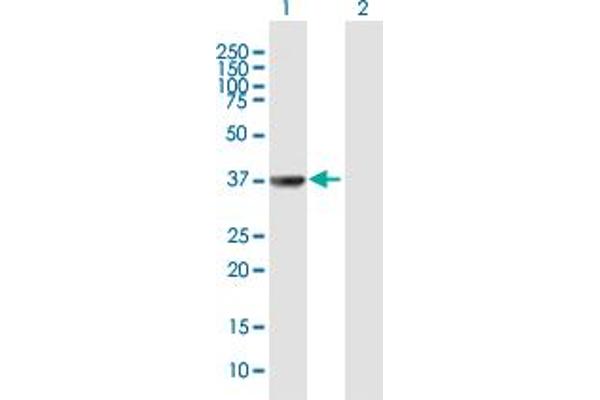 TAF5L Antikörper  (AA 1-325)