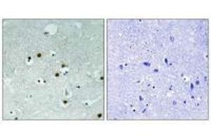 Immunohistochemistry analysis of paraffin-embedded human braina tissue using HP1 alpha (Ab-92) antibody. (CBX5 antibody  (Ser92))