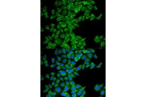 Immunofluorescence analysis of MCF-7 cell using DIABLO antibody. (DIABLO antibody  (AA 1-232))