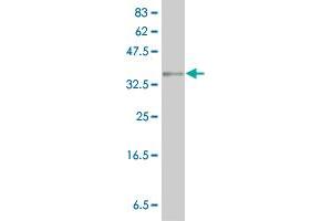 Western Blot detection against Immunogen (36. (LYPLA1 antibody  (AA 133-230))