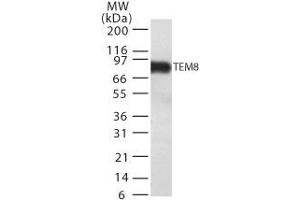 Image no. 1 for anti-anthrax Toxin Receptor 1 (ANTXR1) (AA 481-497) antibody (ABIN208216) (ANTXR1 antibody  (AA 481-497))