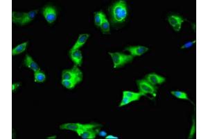 Immunofluorescent analysis of Hela cells using ABIN7160855 at dilution of 1:100 and Alexa Fluor 488-congugated AffiniPure Goat Anti-Rabbit IgG(H+L) (SIRT2 antibody  (AA 177-279))