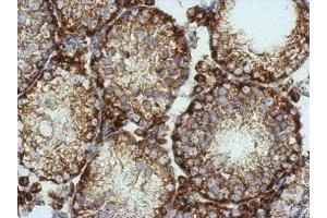 IHC-P Image Immunohistochemical analysis of paraffin-embedded mouse testis, using KCNG4, antibody at 1:500 dilution. (KCNG4 antibody  (Center))