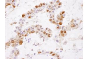 Immunohistochemistry (IHC) image for anti-Glutathione S-Transferase pi 1 (GSTP1) (AA 160-210) antibody (ABIN7453941)