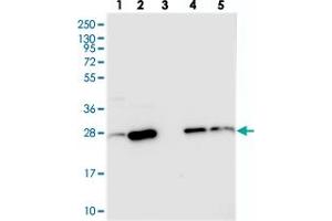 Western blot analysis of Lane 1: RT-4, Lane 2: U-251 MG, Lane 3: Human Plasma, Lane 4: Liver, Lane 5: Tonsil with CRIP2 polyclonal antibody  at 1:250-1:500 dilution.