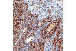 Immunohistochemistry (IHC) image for anti-Protein Kinase, CAMP-Dependent, Regulatory, Type II, beta (PRKAR2B) antibody (ABIN7269663)