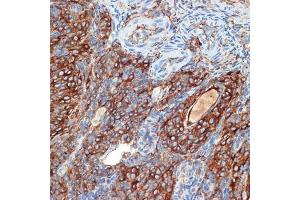 Immunohistochemistry of paraffin-embedded rat ovary using PRKB Rabbit mAb (ABIN7269663) at dilution of 1:100 (40x lens). (PRKAR2B antibody)