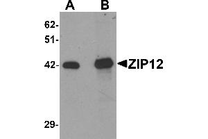 Western Blotting (WB) image for anti-Solute Carrier Family 39 (Zinc Transporter), Member 12 (SLC39A12) (N-Term) antibody (ABIN1031680) (SLC39A12 antibody  (N-Term))