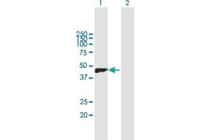 Western Blot analysis of VCAN expression in transfected 293T cell line by VCAN MaxPab polyclonal antibody. (Versican antibody  (AA 1-354))