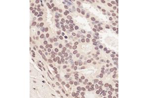 Immunohistochemistry (IHC) image for anti-Ring Finger Protein 2 (RNF2) (AA 150-200) antibody (ABIN7454881)