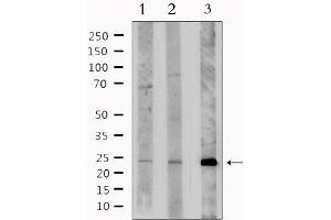 Western blot analysis of extracts from various samples, using BNIP3L Antibody. (BNIP3L/NIX antibody  (Internal Region))