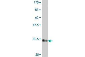 Western Blot detection against Immunogen (33. (GSX2 antibody  (AA 1-70))