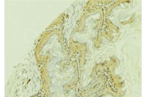 ABIN6273744 at 1/100 staining Mouse colon tissue by IHC-P. (CYP4F12 antibody)