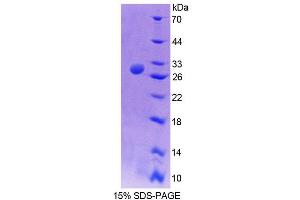 SDS-PAGE analysis of Mouse TCEA2 Protein. (TCEA2 Protein)