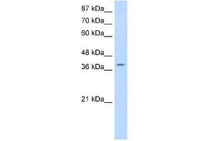 MYST4 antibody used at 0. (KAT6B antibody  (N-Term))