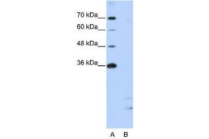 WB Suggested Anti-PPIE  Antibody Titration: 2. (PPIE antibody  (Middle Region))