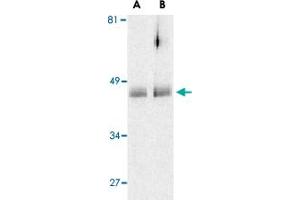 Western blot analysis of HTRA2 in human colon cell lysates with HTRA2 polyclonal antibody  at (A) 0. (HTRA2 antibody  (C-Term))