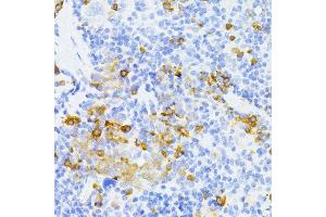 Immunohistochemistry of paraffin-embedded mouse spleen using MMP2 antibody. (MMP2 antibody  (AA 40-280))