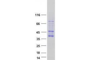 Cyclin-Dependent Kinase 10 (CDK10) (Transcript Variant A) protein (Myc-DYKDDDDK Tag)