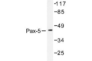 Image no. 1 for anti-Paired Box 5 (PAX5) antibody (ABIN271778) (PAX5 antibody)