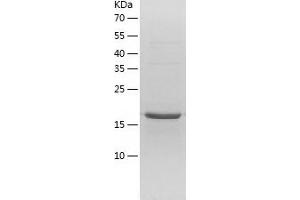Western Blotting (WB) image for RNA Polymerase II TBP-Associated Factor Subunit G (TAF9) (AA 1-172) protein (His tag) (ABIN7289520) (TAF9 Protein (AA 1-172) (His tag))