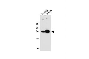 All lanes : Anti-GSTM4 Antibody (N-term) at 1:1000 dilution Lane 1: Human lung tissue lysate Lane 2: Human liver tissue lysate Lysates/proteins at 20 μg per lane. (GSTM4 antibody  (N-Term))