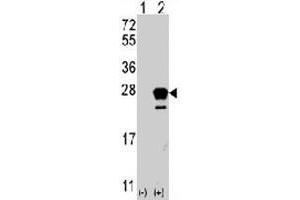 Western blot analysis of NRAS (arrow) using rabbit NRAS polyclonal antibody . (GTPase NRas antibody  (N-Term))