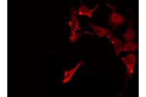 ABIN6275944 staining HeLa by IF/ICC. (FZD1 antibody  (N-Term))