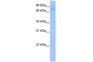 Western Blot showing ZNF440 antibody used at a concentration of 1-2 ug/ml to detect its target protein. (ZNF440 antibody  (C-Term))