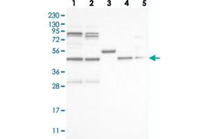 Western blot analysis of Lane 1: RT-4, Lane 2: U-251 MG, Lane 3: Human Plasma, Lane 4: Liver, Lane 5: Tonsil with VPS37A polyclonal antibody  at 1:250-1:500 dilution. (VPS37A antibody)