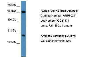WB Suggested Anti-KBTBD8  Antibody Titration: 0. (KBTBD8 antibody  (N-Term))