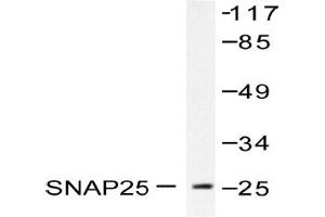 Image no. 1 for anti-Synaptosomal-Associated Protein, 25kDa (SNAP25) antibody (ABIN271818) (SNAP25 antibody)