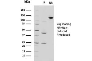 SDS-PAGE AnalysisPurified Cadherin 17 / CDH17 Mouse Monoclonal Antibody (CDH17/2618). (LI Cadherin antibody  (AA 242-418))