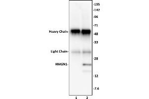 HMGN1 antibody (pAb) tested by Immunoprecipitation. (HMGN1 antibody  (C-Term))