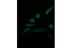 Image no. 2 for anti-D-Dopachrome Tautomerase (DDT) antibody (ABIN1497794) (DDT antibody)