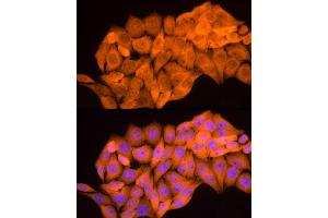 Immunofluorescence (IF) image for anti-Aldo-Keto Reductase Family 1, Member B1 (Aldose Reductase) (AKR1B1) (AA 1-316) antibody (ABIN3022391)
