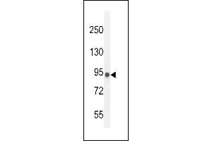 IL12RB2 Antibody (C-term) (ABIN654644 and ABIN2844340) western blot analysis in MDA-M cell line lysates (35 μg/lane). (IL12_2 (AA 756-783), (C-Term) antibody)