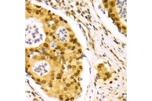 Immunohistochemistry (Paraffin-embedded Sections) (IHC (p)) image for anti-ELAV (Embryonic Lethal, Abnormal Vision, Drosophila)-Like 1 (Hu Antigen R) (ELAVL1) (AA 1-326) antibody (ABIN3022231)