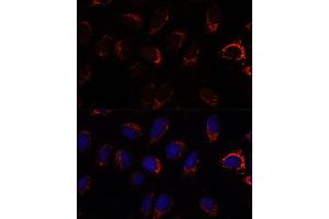 Immunofluorescence analysis of U-2 OS cells using S2 antibody (ABIN7265451) at dilution of 1:100. (AP3S2 antibody  (AA 1-193))