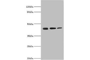Western blot All lanes: Actin-related protein 2 antibody at 3 μg/mL Lane 1: Mouse spleen tissue Lane 2: Jurkat whole cell lysate Lane 3: MCF-7 whole cell lysate Secondary Goat polyclonal to rabbit IgG at 1/10000 dilution Predicted band size: 45, 46 kDa Observed band size: 45 kDa (ACTR2 antibody  (AA 1-160))