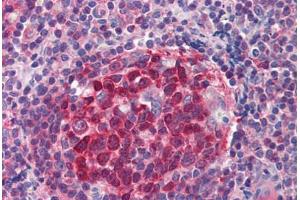 Human Tonsil (formalin-fixed, paraffin-embedded) stained with RRM2B antibody ABIN214469 at 2. (RRM2B antibody  (AA 2-17))